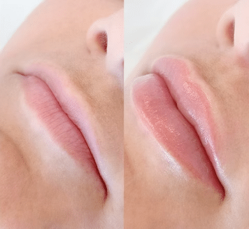Micropigmentación de labios