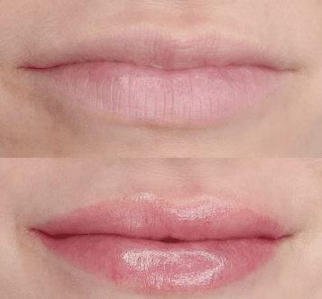 Micropigmentación de labios