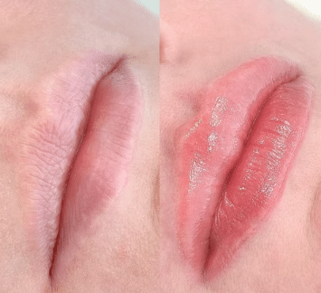 Micropigmentación de labios